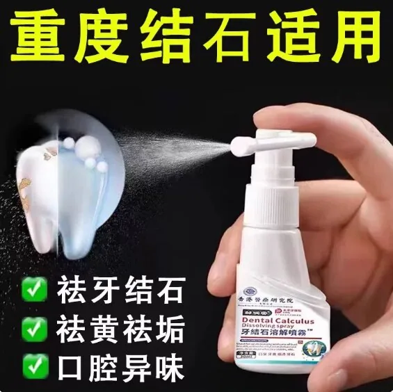 呦越牙结石溶解剂2瓶装