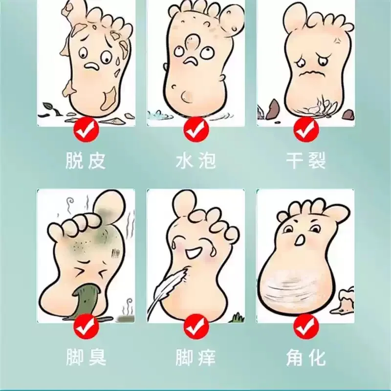 呦越云南本草臭脚脚气喷雾【3瓶】