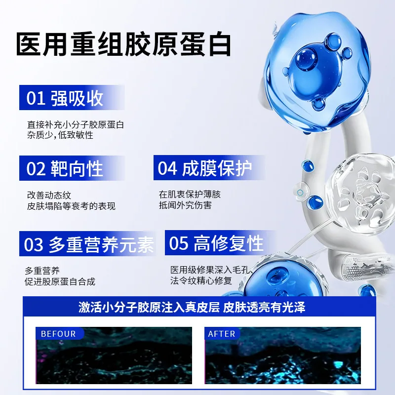 ZACOLLAN植蔻兰医用重组胶原蛋白修复敷料乳50g（细节图 1）