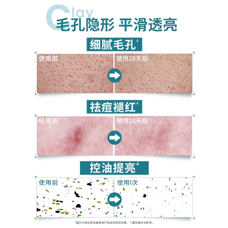 雅漾反孔小绿泥膜涂抹面膜罐装（细节图 1）