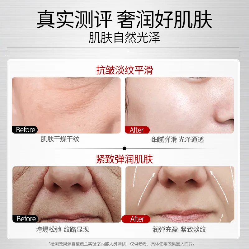 植蔻兰医用修复皮肤屏障乳软管装（细节图 2）