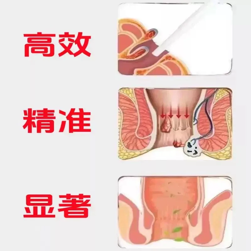 痔立克冷肤凝胶3支装