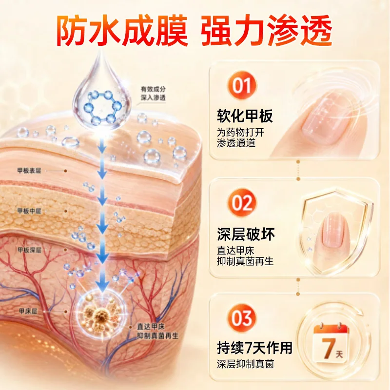 时景大药房阿莫罗芬搽剂2.5ml小瓶装（细节图 1）