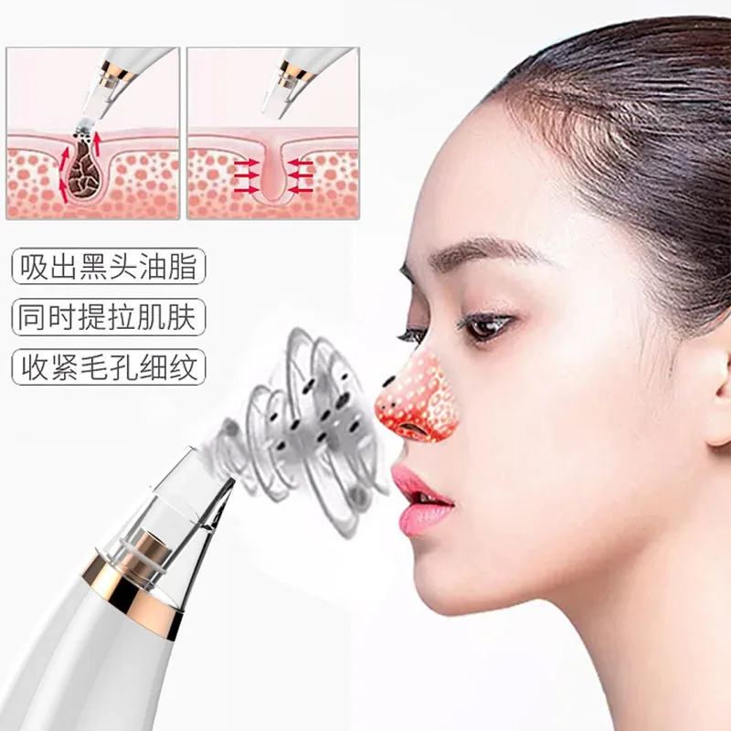 顶真好货黑头清洁美容仪