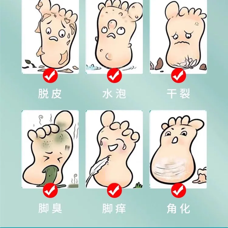 顺通美云南本草脚气喷雾60ml*3瓶