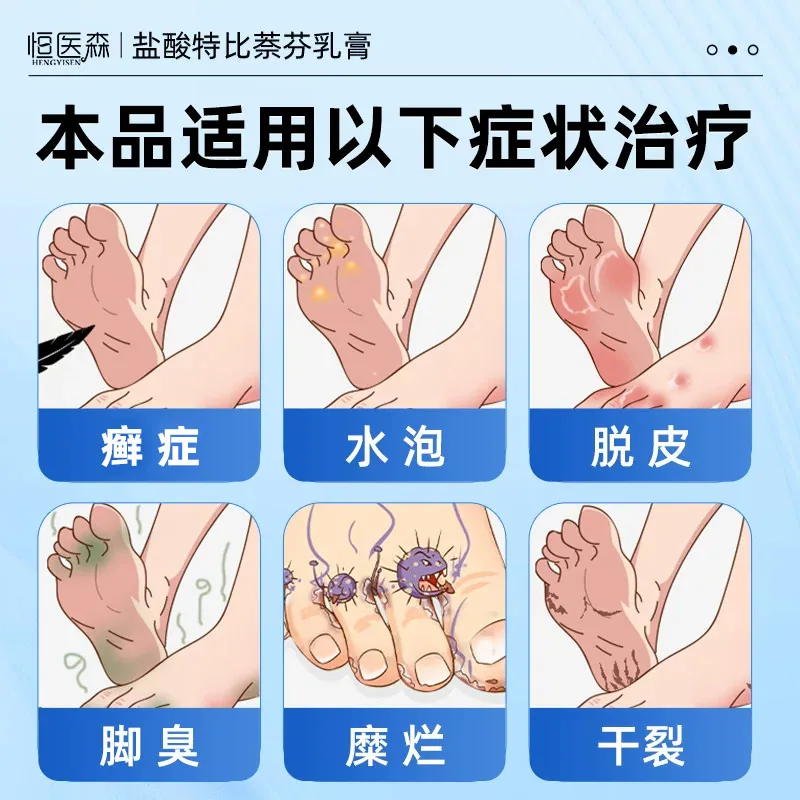 盐酸特比萘芬乳膏