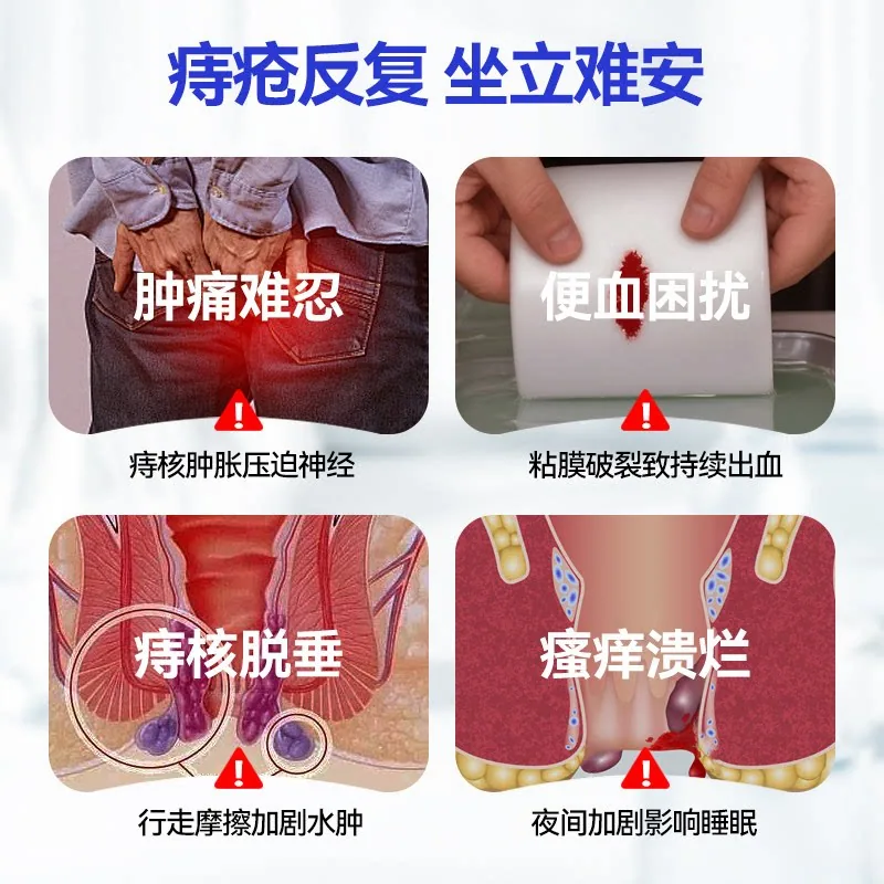 SRSR医用痔疮凝胶