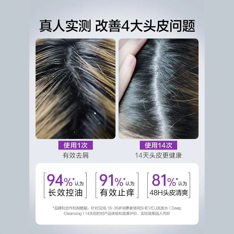 澳洲赛逸去屑控油蓬洗发水400ml瓶装（细节图 2）