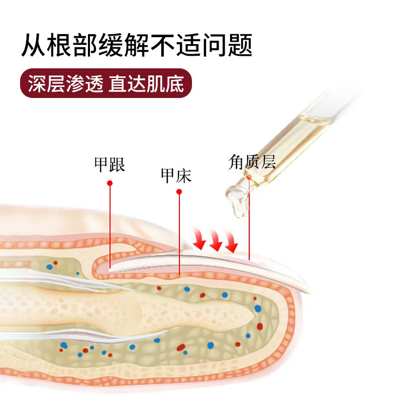 王泰林灰甲护理液拍一发二套装（细节图 2）