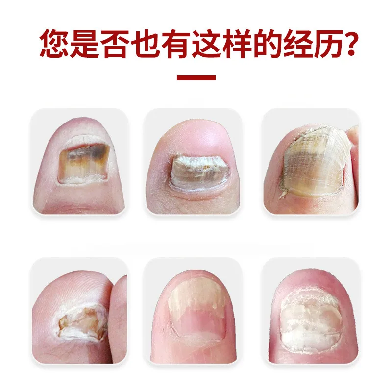 王泰林灰甲护理液两件装