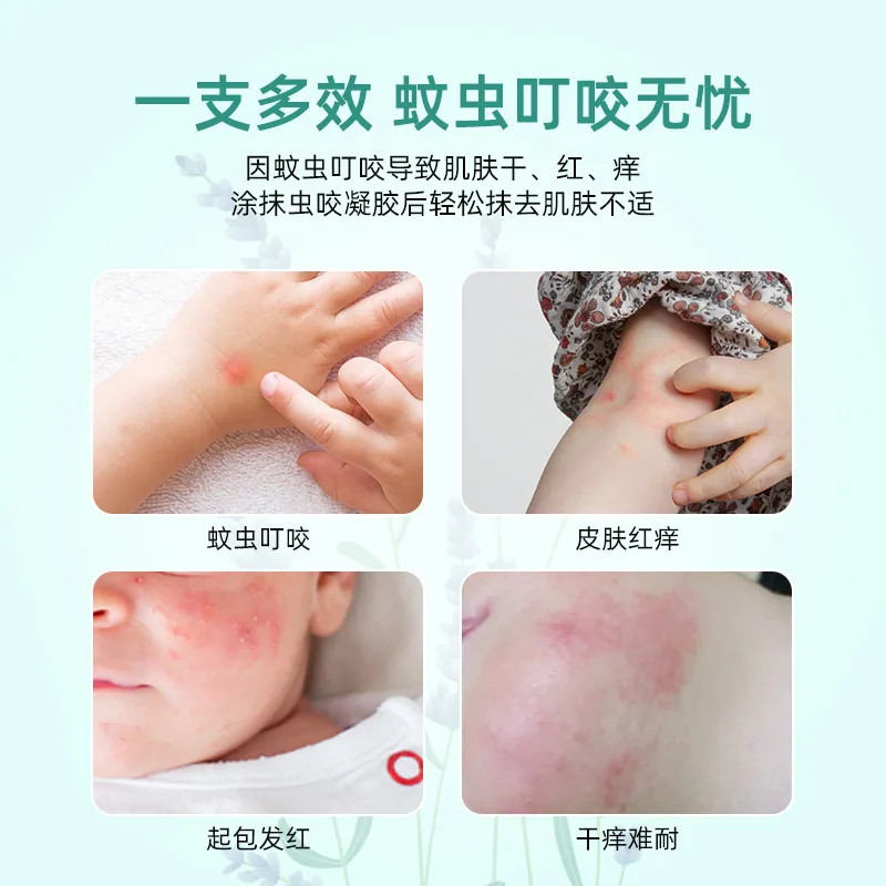 贝比安鸸鹋宝宝虫咬凝胶20g一支装（细节图 1）