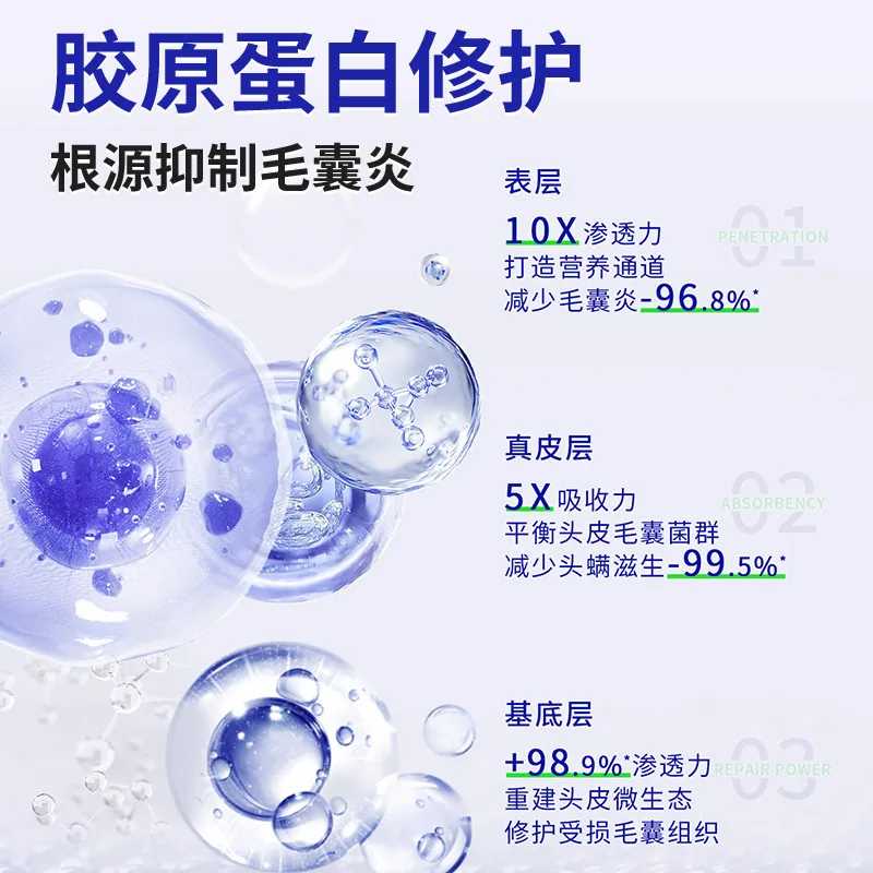 葵花溢脂性皮炎非洗发水240ml瓶装（细节图 2）