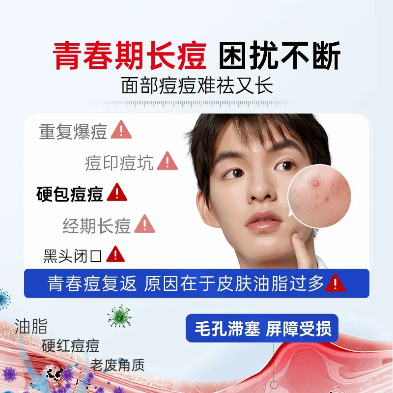 VKVH美白祛斑抗皱修护祛痘霜2支