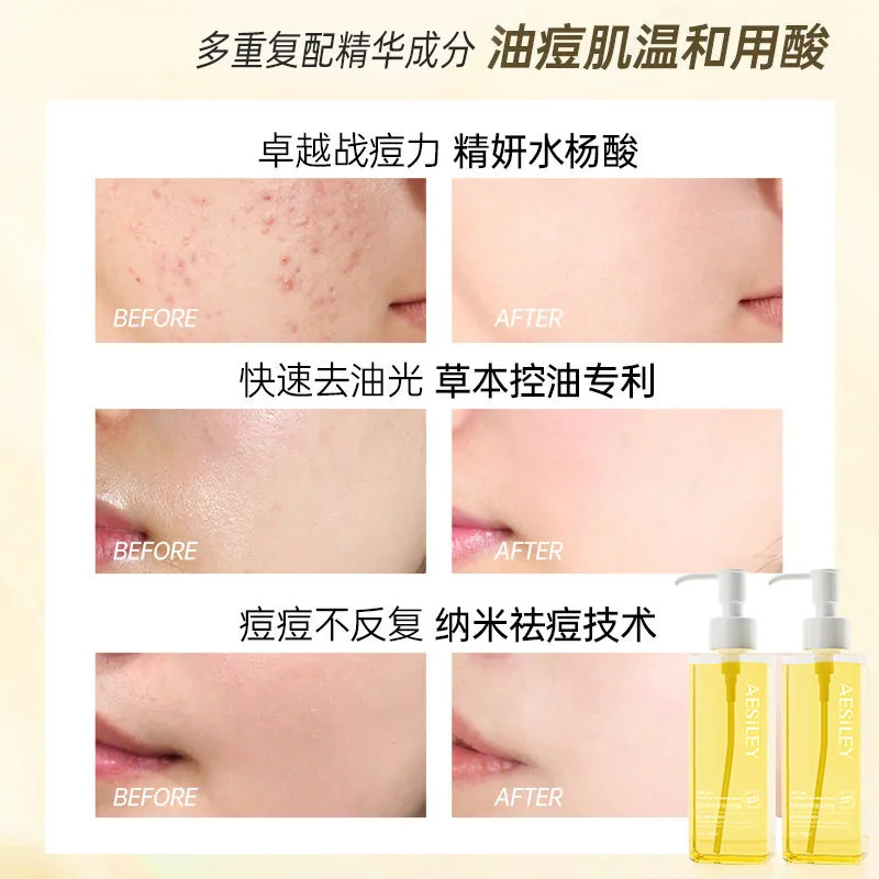 aesiley黑茶洁颜蜜卸妆油180ml两瓶装（细节图 2）