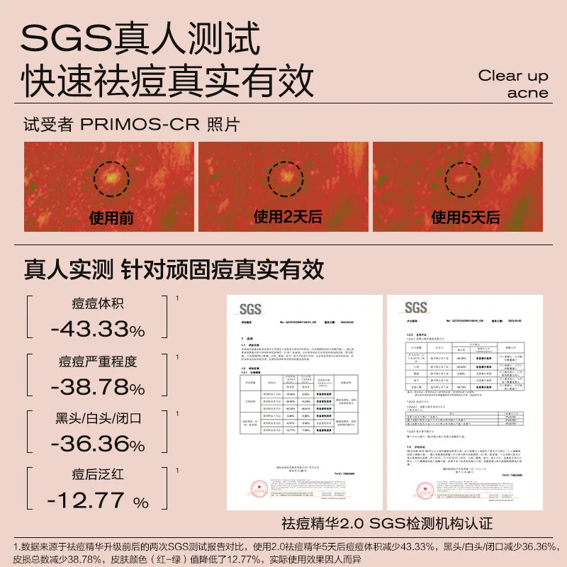 大水滴3点祛痘精华2.0 7ml加3ml（细节图 1）