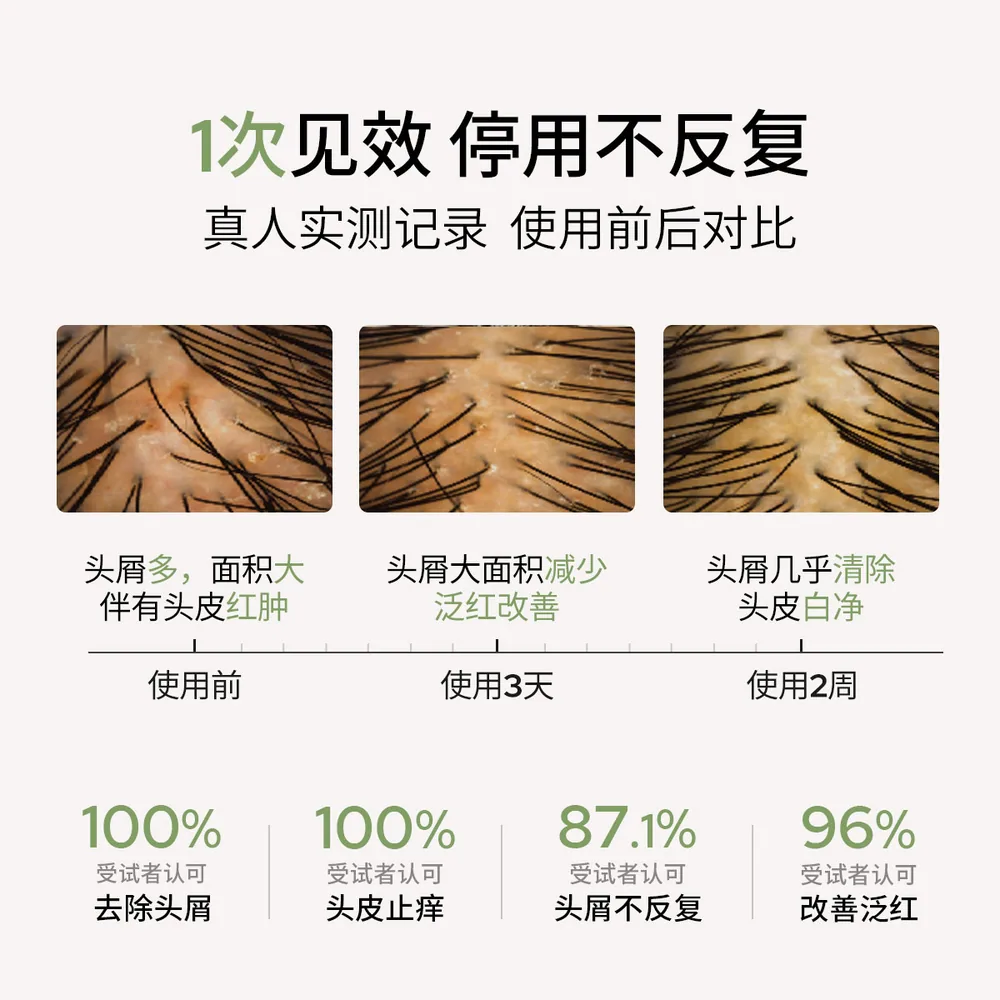 若也去屑止痒洗发水控油蓬松男女通用套装（细节图 2）