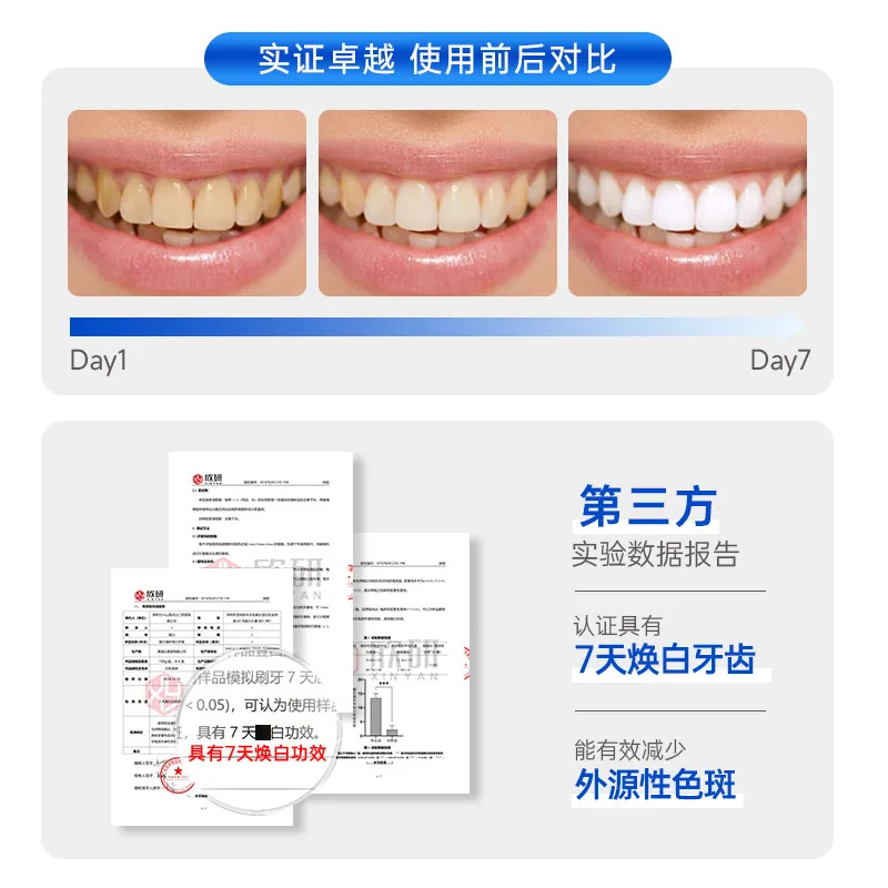 OneCharm壹白去渍牙膏3支装（细节图 1）