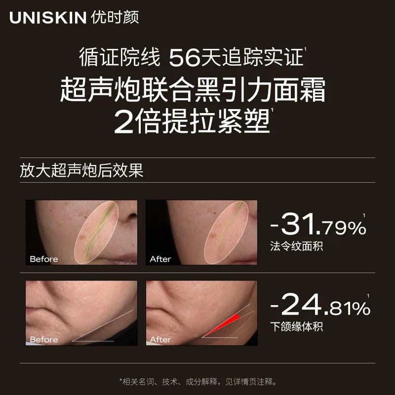 优时颜第二代黑引力面霜50g加替换芯（细节图 2）