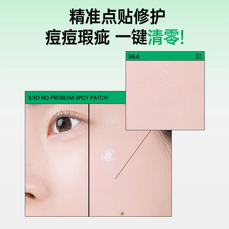 ilso一苏果酸痘痘贴72片超薄隐形（细节图 2）