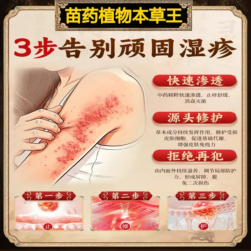 滋舒承千年苗族传承拔毒止痒膏抑菌膏（细节图 1）