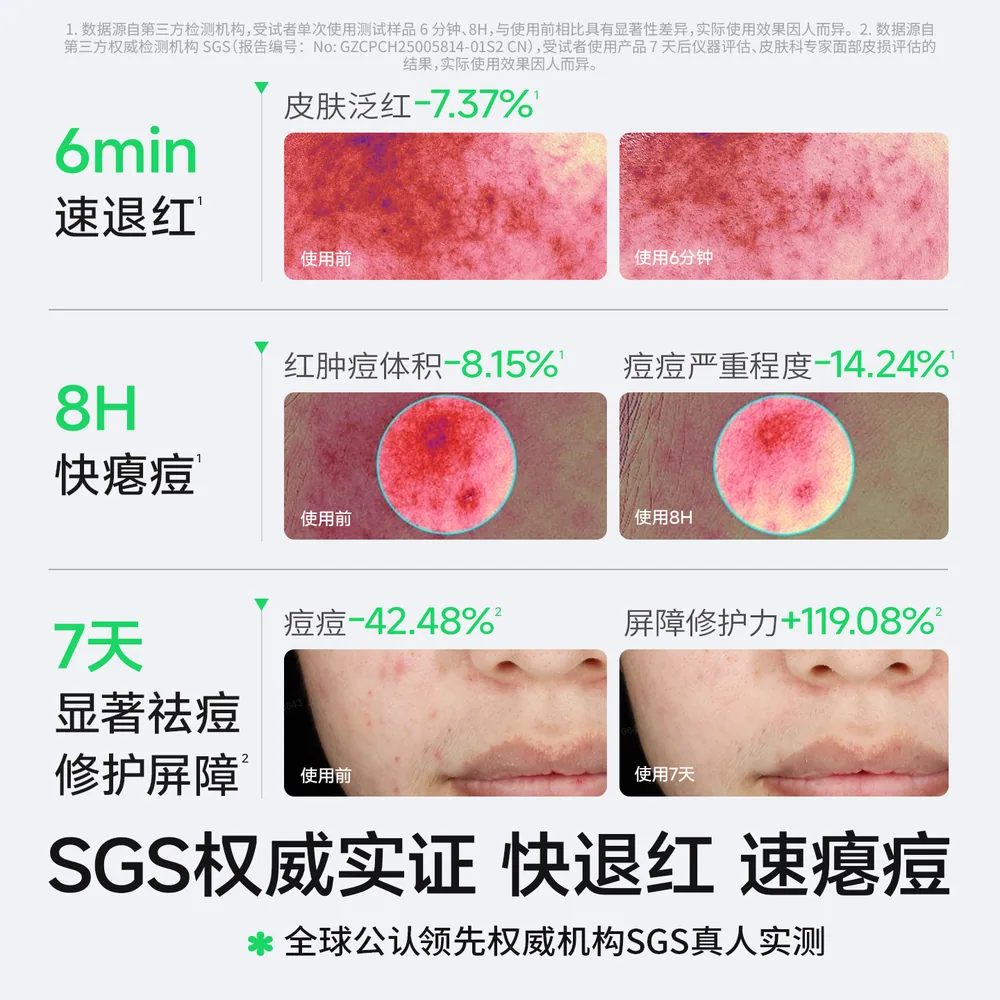 海龟爸爸祛痘精华液次抛正装及1ml赠品（细节图 1）