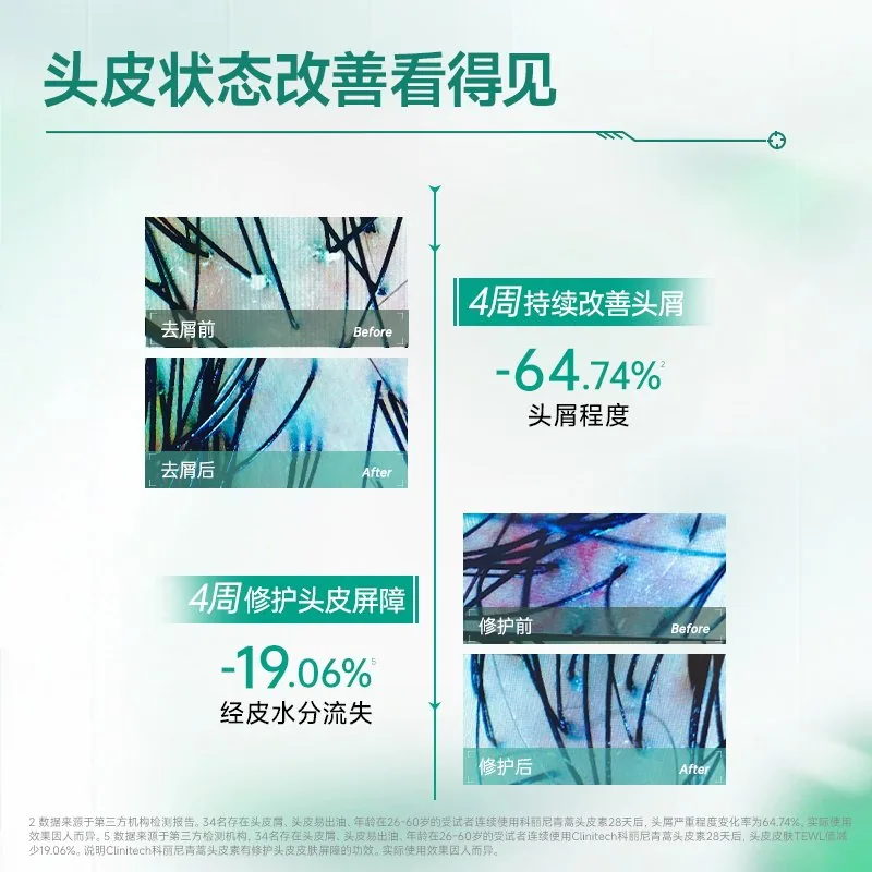 科丽尼头皮素128ml与净屑洗发水260g（细节图 1）