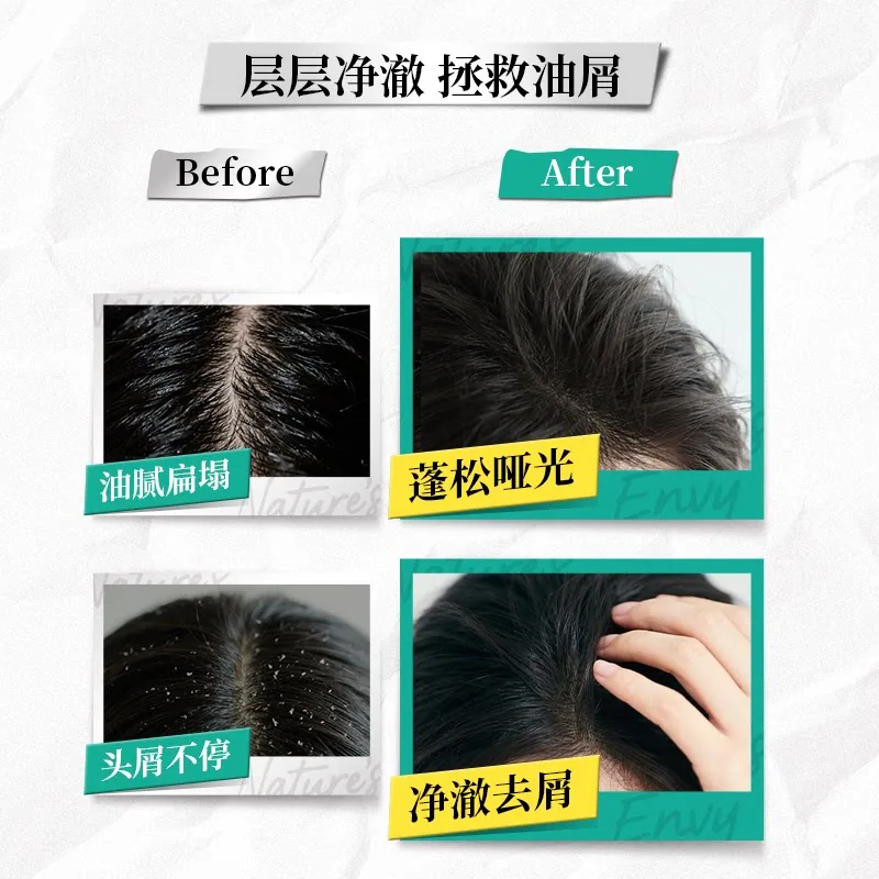 天然之扉进口蓬发小银*2两瓶装（细节图 1）