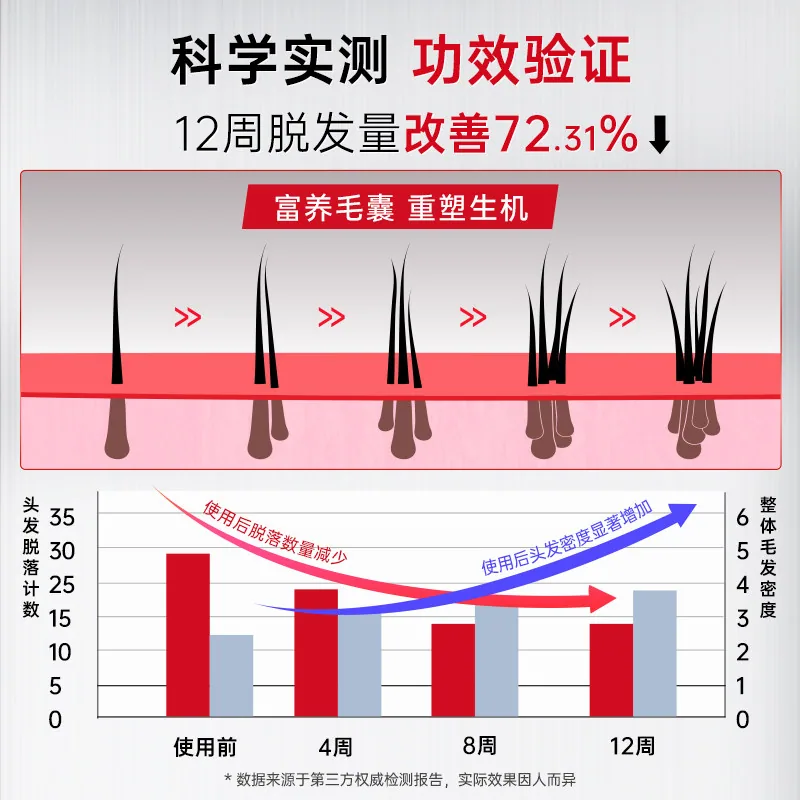 卡蓓诺防脱修护洗发水洗护合集（细节图 2）