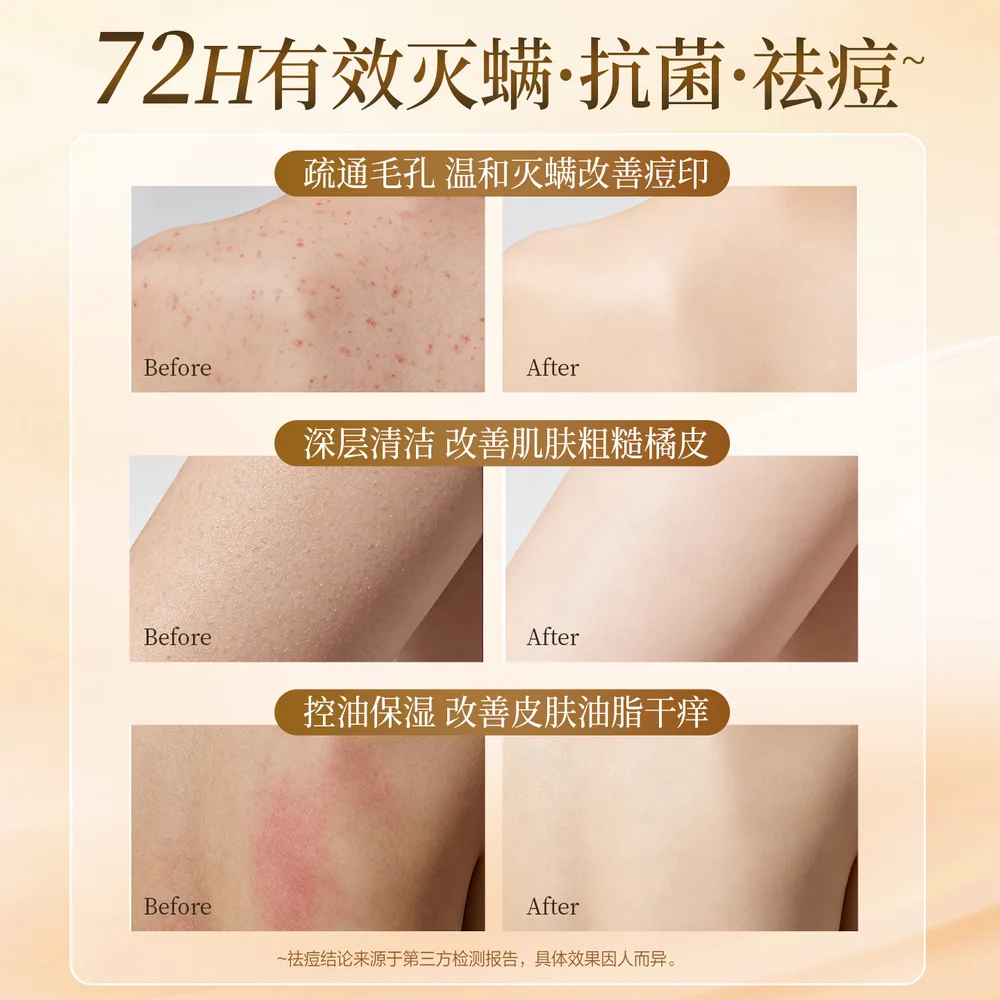纳爱斯液体硫磺皂（细节图 2）