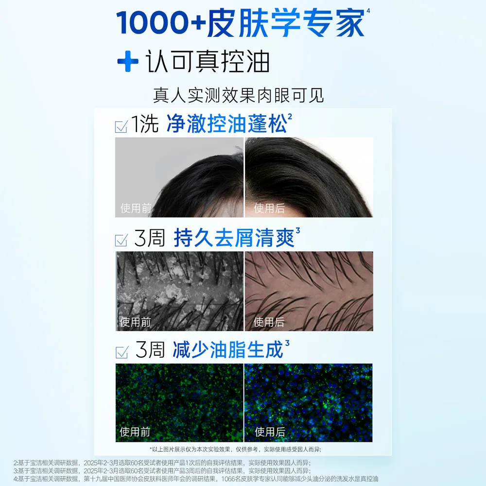 海飞丝控油蓬松去屑洗发水大瓶装