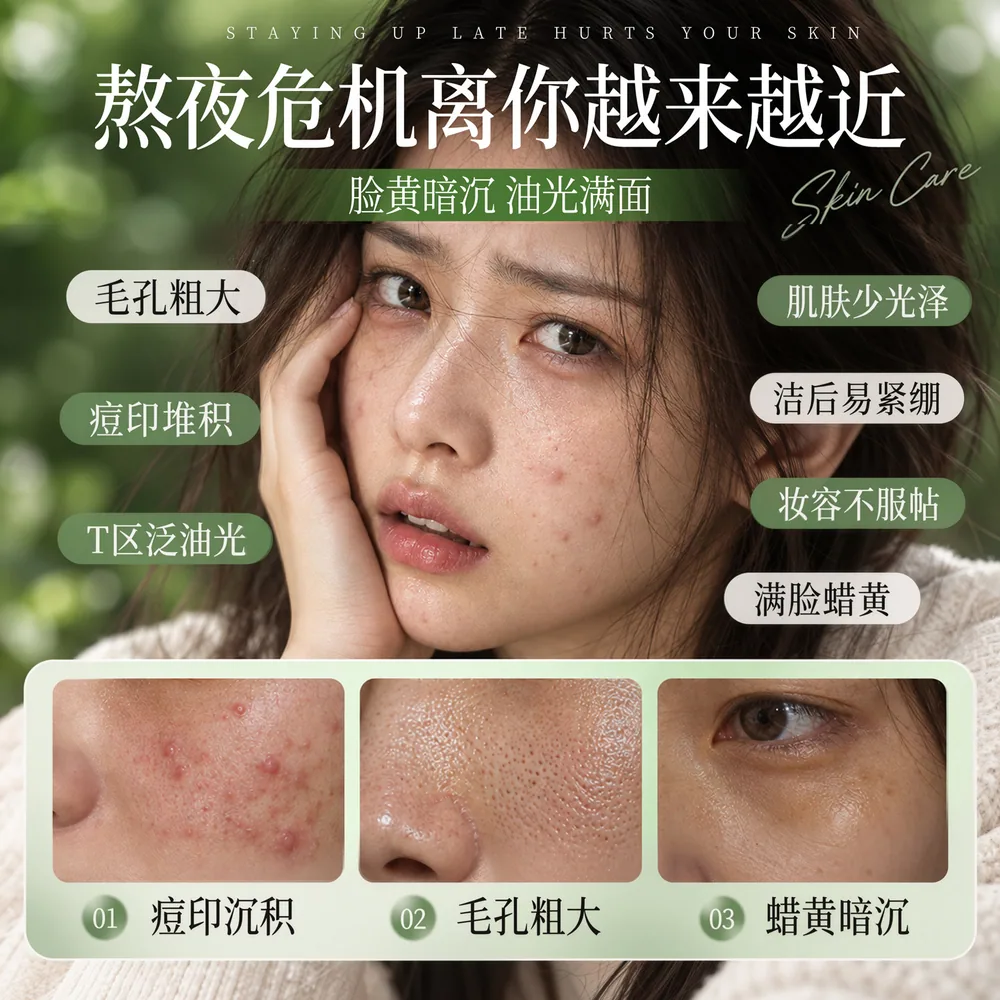 欧泉琳去黑头洗脸皂110g带起泡网