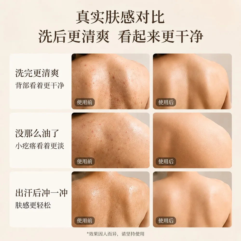 欧泉琳液体硫磺皂大瓶装（细节图 1）